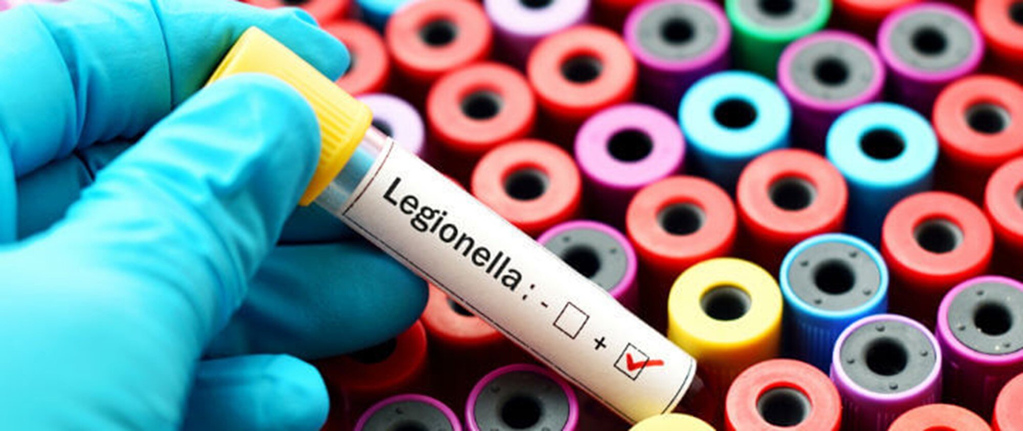LEGIONELLA PNEUMOPHILA SAMPLING
