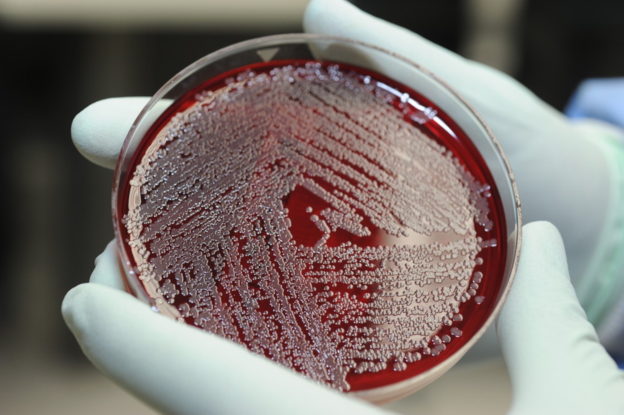 PSEUDOMONAS AERUGINOSA SAMPLING